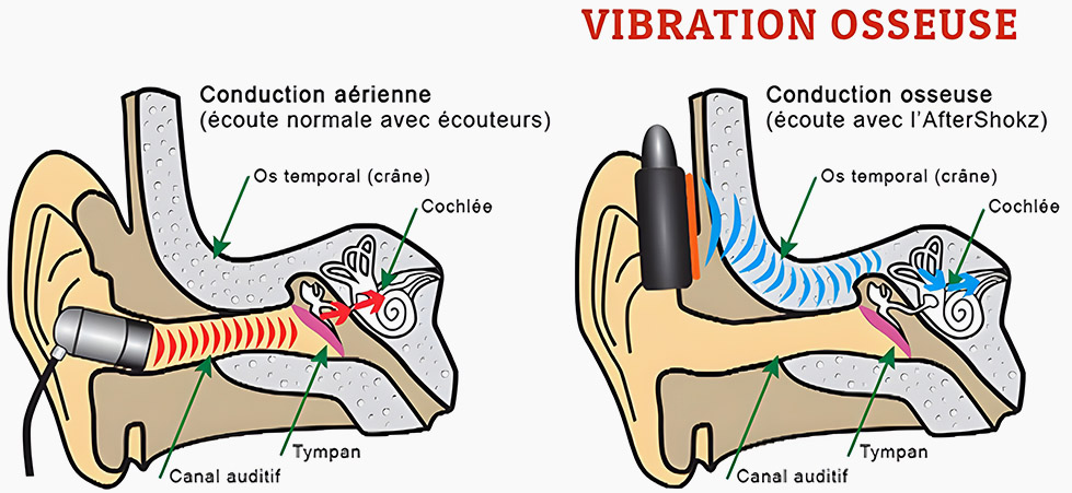 Il s'agit d'un schema explicatif de la conduction osseuse. Sont présentées deux oreilles. A gauche une oreille présentant la conduction aérienne. A droite une oreille présentant la conduction osseuse. Dans le schéma de gauche représentant la conduction aérienne, il y a des écouteurs qui rentrent dans les oreilles. Dans le schéma de droite présentant la conduction osseuse, les écouteurs ne rentrent pas dans l'oreille, mais sont posés sur la tempe. De petites vibrations sont illustrées par des arcs de cercles bleus en direction du tympa qui circulent par l'os temporal (du crâne). Dans le schéma de gauche, ce sont des ondes qui passent par le canal auditif.